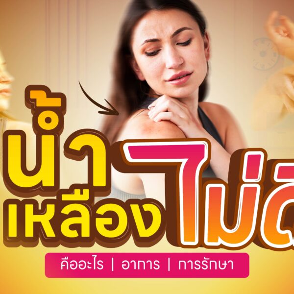น้ำเหลืองไม่ดี โรคนี้มีจริงไหม?