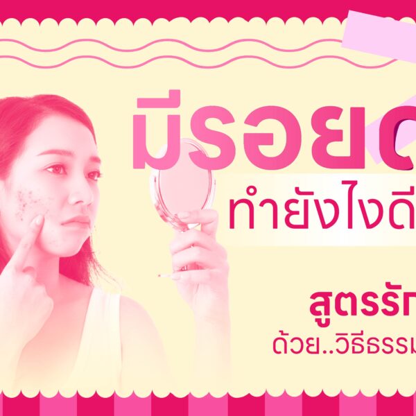 มีรอยดำ ทำยังไงดี ?