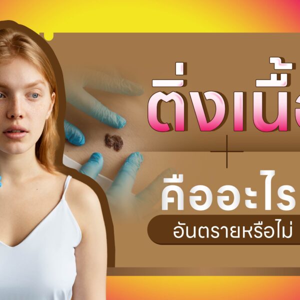 ติ่งเนื้อ คืออะไร? อันตรายหรือไม่ ?